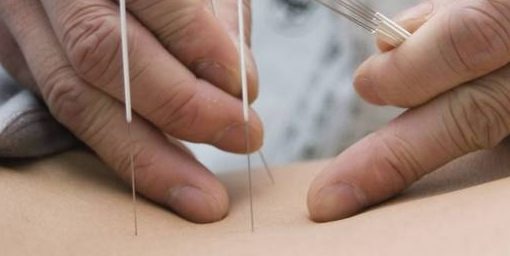 سوزنی و خون گیری خانم موسوی